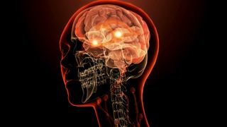 An artist's 3D rendering of a brain in the outline of a face and skull. There are two glowing dots near the center of the brain.