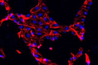 endothelial cells may someday control cancer