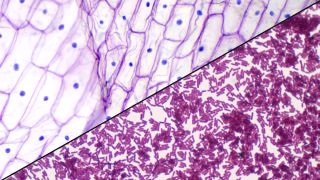 difference between prokaryotic and eukaryotic cells under a microscope