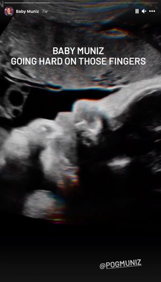 Frankie Muniz Sonogram