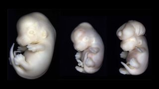 Three mouse embryos. The far left embryo is healthy and was not exposed to valproic acid; the right two embryos were exposed to valproic acid. The center embryo has microcephaly (meaning a small head) and the far right embryo has exencephaly (meaning the portion of the neural tube closest to its head is open).