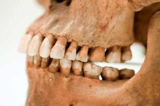 A close-up photo of teeth in a human skull