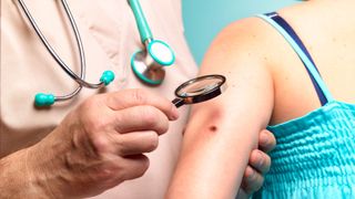 Doctor examining woman with melanoma.