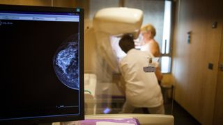 in the foreground, there&#039;s a computer screen showing a mammogram. Blurred in the background, we can see a medical provider in a white coat assisting a patient at a mammogram machine