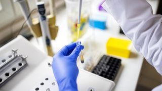 Close-up image of a scientists' hand as they pipette liquid into a test tube. They are wearing blue lab gloves and a white lab coat. The background is blurred but other lab equipment can be seen