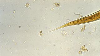 A larva of a hookworm.