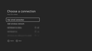 Xbox Series Set Up Network