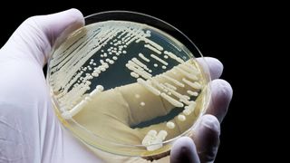 A gloved hand holds a petri dish with a culture of yeast