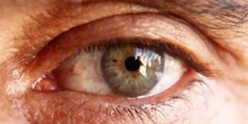 Eye of an older male