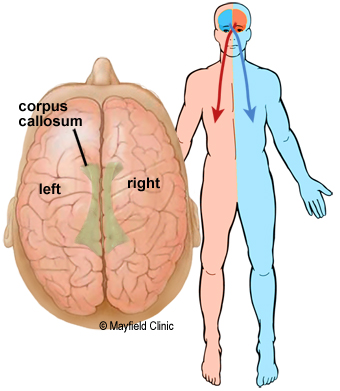 Left and right hemispheres