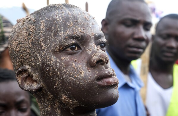 Daniel Wabuyi reacts during his traditional circumcision ritual, known as Imbalu, at Kamu village in Mbale, Eastern Uganda, Saturday, Aug. 3, 2024. (AP Photo/Hajarah Nalwadda)