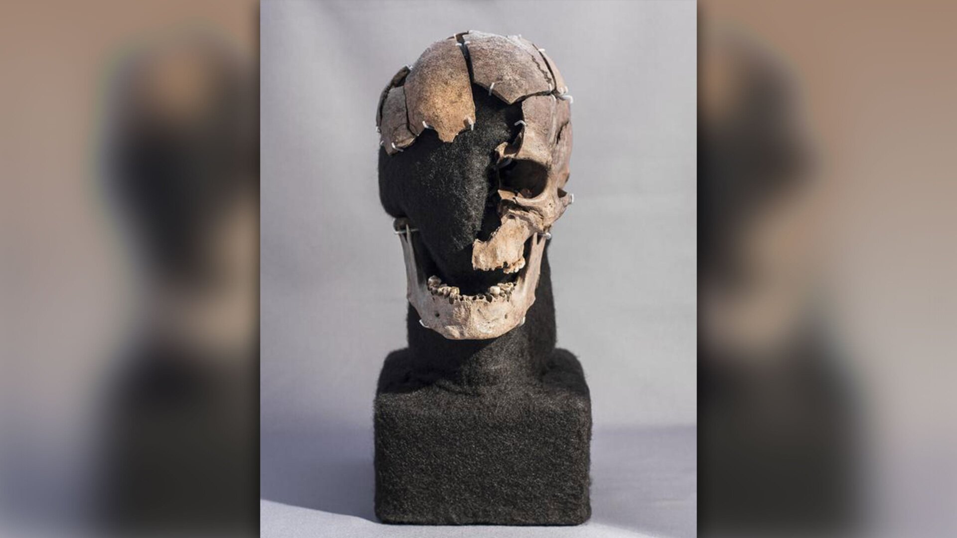 The shattered skull of Vittrup Man.