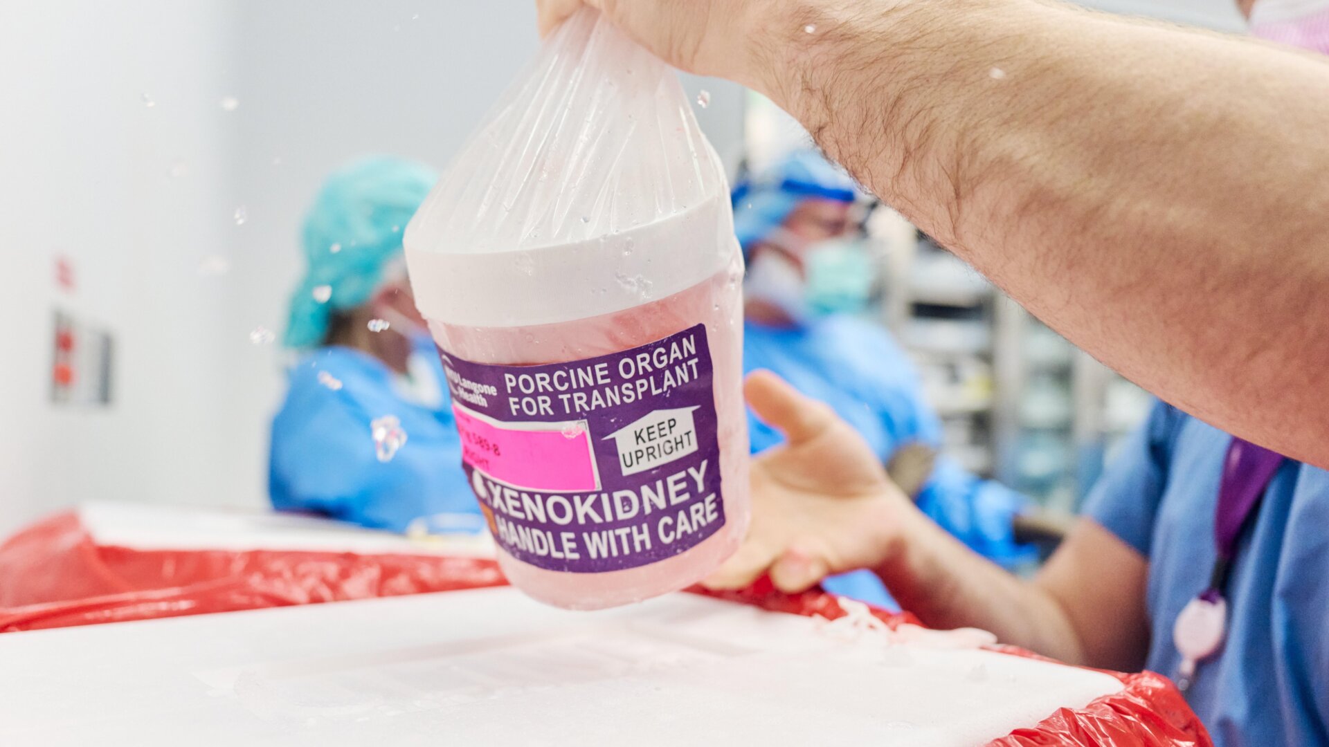 The gene-edited pig kidney with thymus is removed from its transport container to be prepared for transplantation