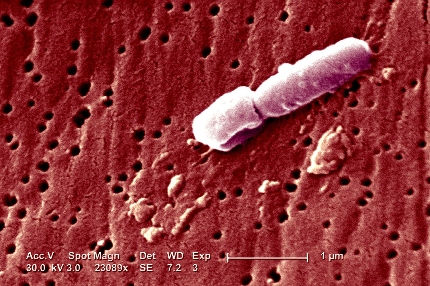 A scanning electron micrograph image of Klebsiella pneumoniae.