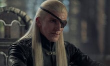 A man with long blonde hair and an eyepatch sits on a chair.