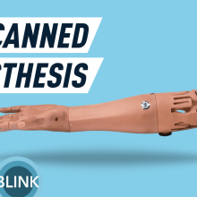 This might be the most customizable and affordable prosthetic arm yet — Future Blink