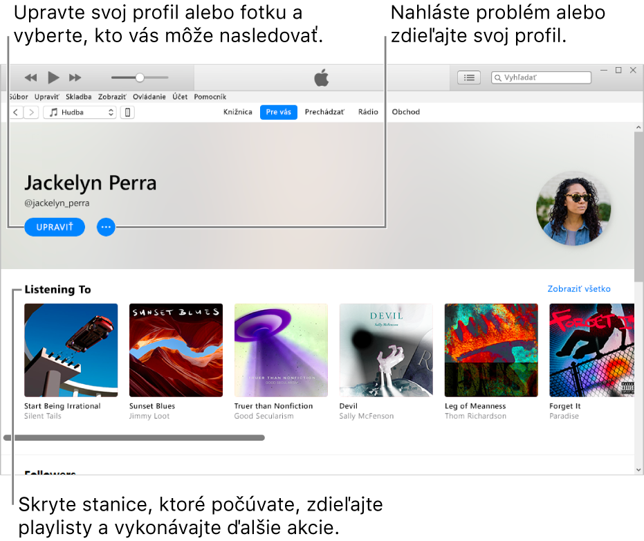 Strana profilu v Apple Music. Ak chcete upraviť svoj profil alebo fotku a vybrať svojich nasledovateľov, kliknite na Upraviť v pravom hornom rohu pod vaším menom. Kliknutím na tlačidlo Menu akcií vpravo od tlačidla Upraviť môžete nahlásiť problém alebo zdieľať svoj profil. V časti Počúvané sú všetky albumy, ktoré počúvate a kliknutím na tlačidlo Menu akcií môžete skryť stanice, ktoré počúvate, zdieľať playlisty a vykonávať ďalšie akcie.