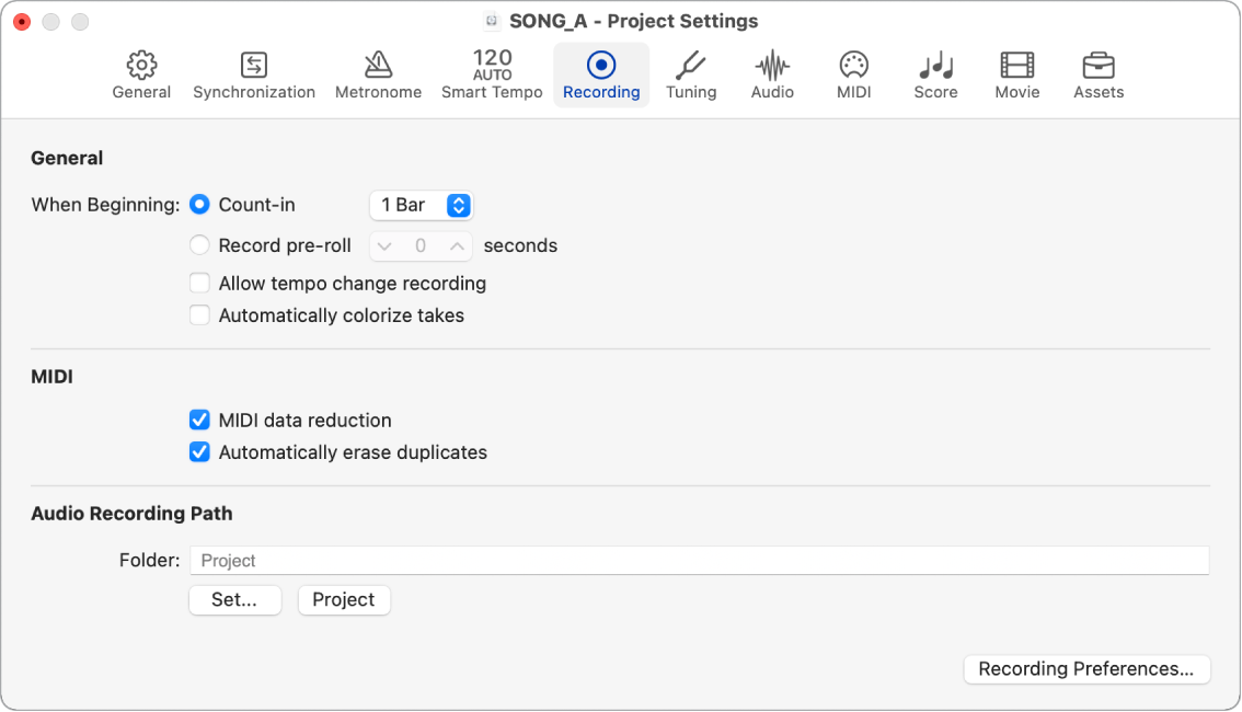 Figure. Recording settings.