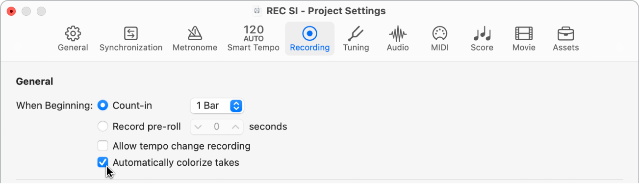 Figure. Sélection, dans la sous-fenêtre des réglages de projet d’enregistrement, de prises de couleur attribuée automatiquement.
