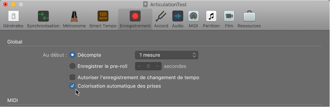 Figure. Sélection, dans la sous-fenêtre des réglages de projet d’enregistrement, de prises de couleur attribuée automatiquement.