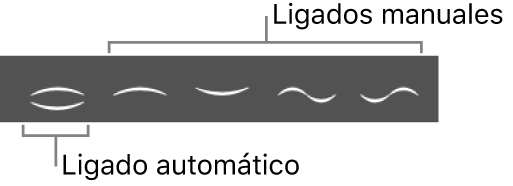 Ilustración. Caja de componentes con ligados automáticos y manuales.