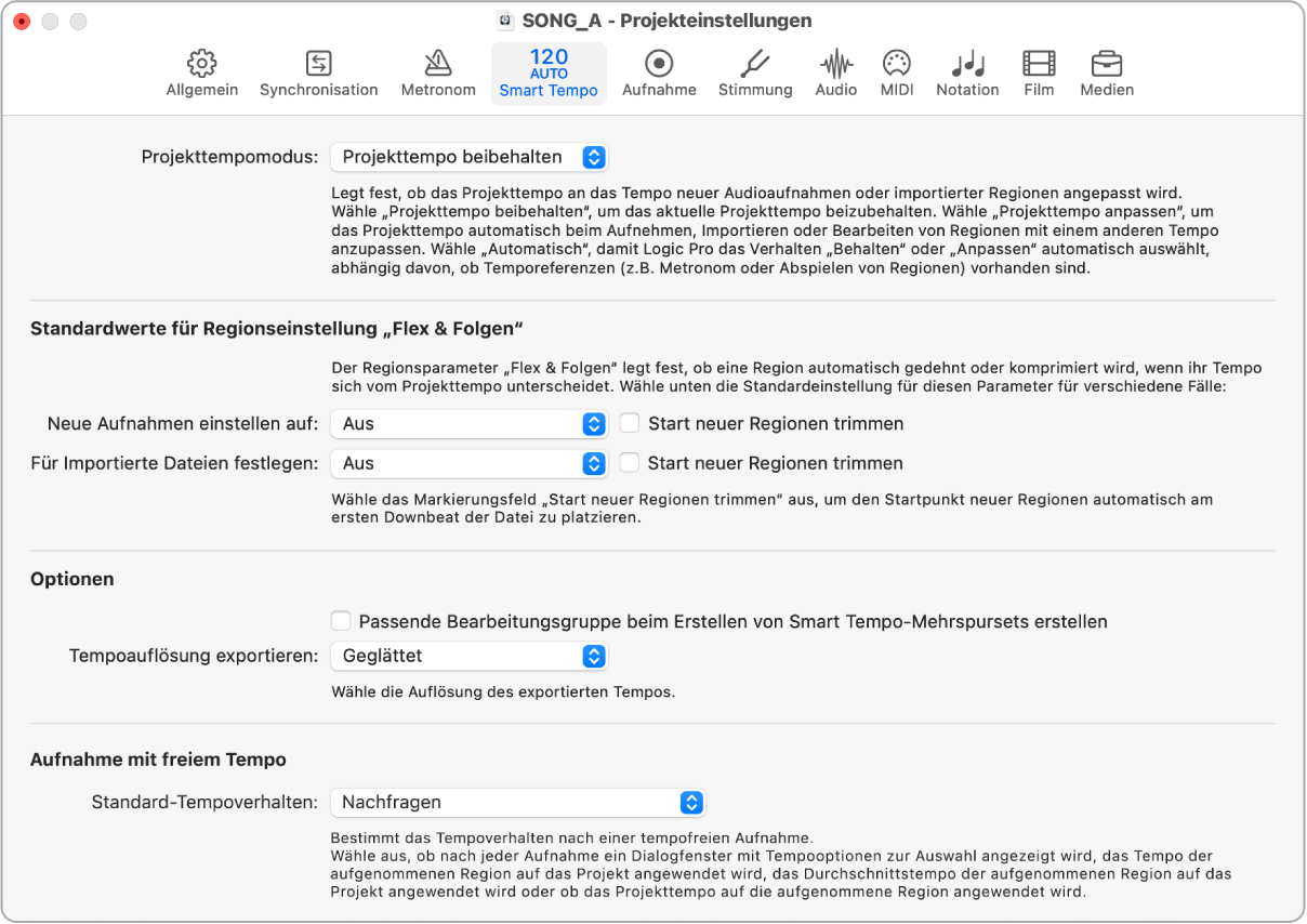 Abbildung. Projekteinstellungsbereich „Smart Tempo“