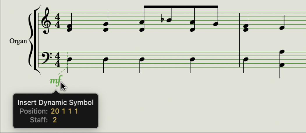 Figure. Guide lines in the Score Editor.