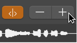 Figure. Plus and Minus buttons in the Sample Editor.