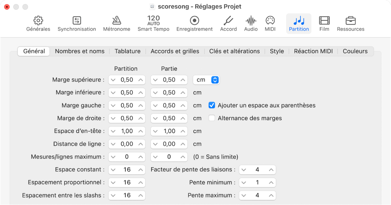 Figure. Sous-fenêtre Global des réglages de partition du projet