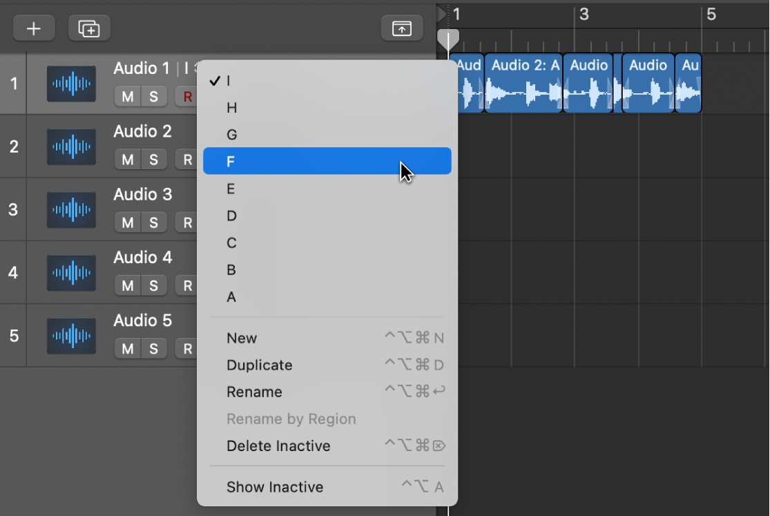 Figure. Takes accessible as track alternatives.