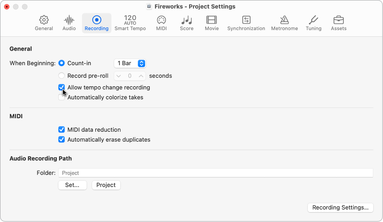 Figure. Recording project settings pane.