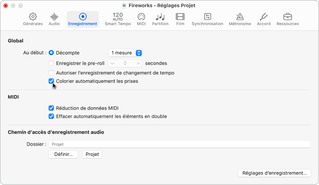 Figure. Sélection, dans la sous-fenêtre des réglages de projet d’enregistrement, de prises de couleur attribuée automatiquement.