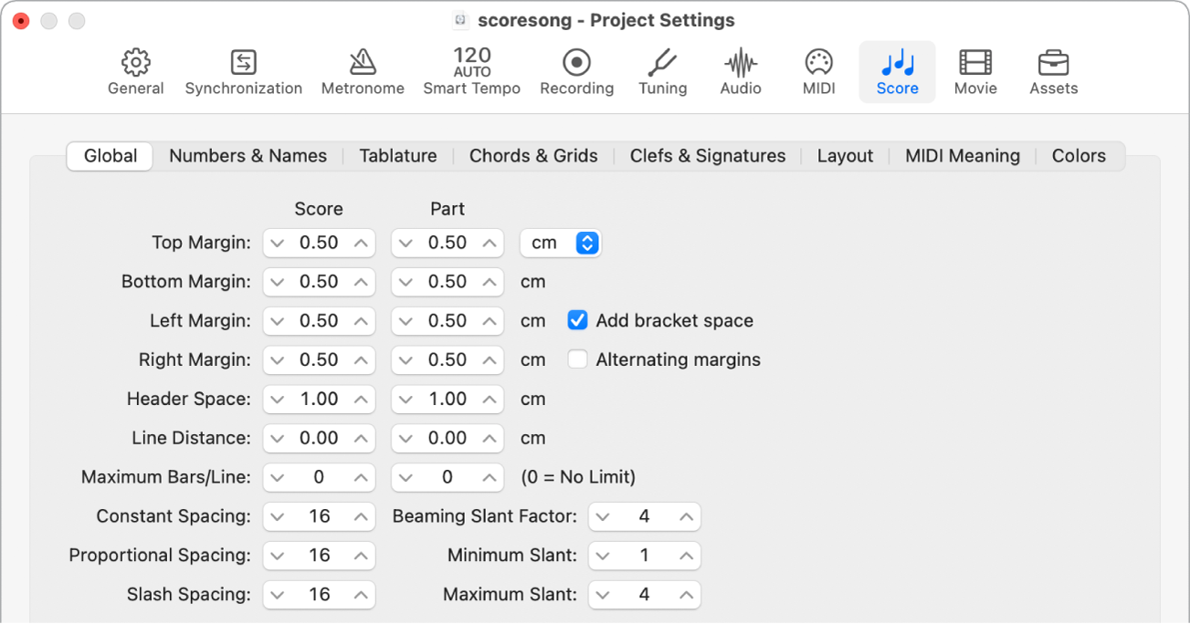 Figure. Global pane in the Score project settings.