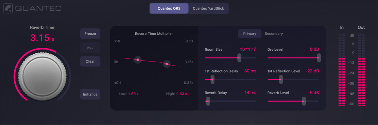 Figure. The main set of QRS parameters.