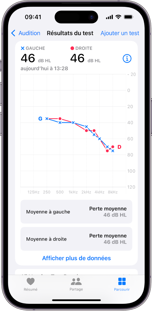 Un audiogramme sur l’iPhone, affichant une perte modérée de l’audition dans les deux oreilles.