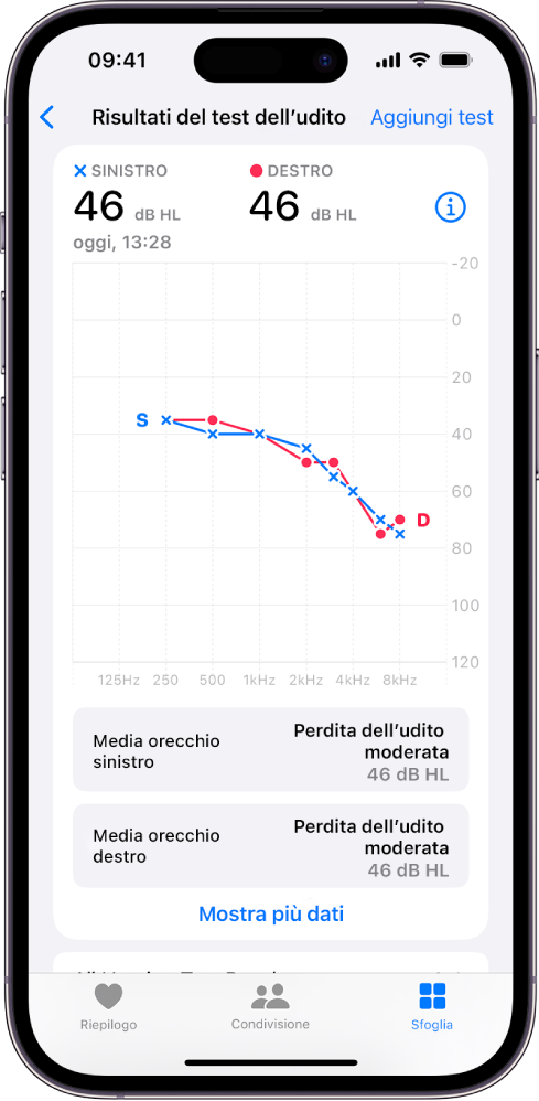 Un audiogramma su iPhone, mostrante una perdita dell’udito di grado moderato in entrambe le orecchie.