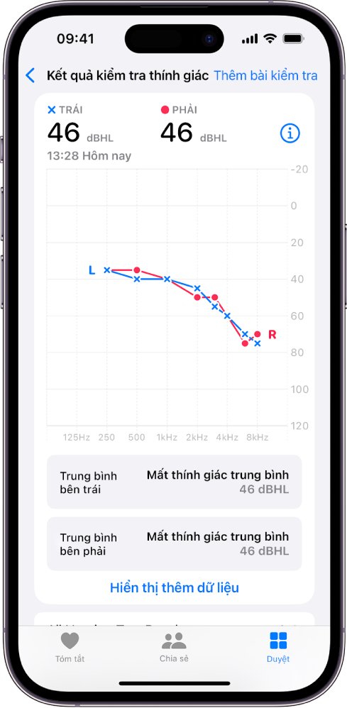 Một thính lực đồ trên iPhone, đang hiển thị mức độ mất thính giác trong cả hai tai.