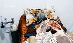 the Israeli detained by the Al-Qassam Brigades, the military wing of Hamas, Hisham al-Sayed, appears lie on a bed with a respirator attached, Gaza city, Gaza Strip, Palestinian Territory - 28 Jun 2022