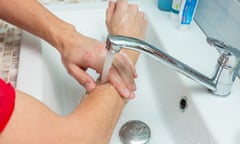 A man washes his hands up to the elbows under the tap