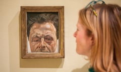 Lucian Freud, Self-portrait with a Black Eye, 1978. at the Royal Academy.