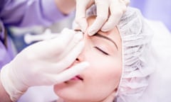 A beauty technician injecting botox into a woman's face.