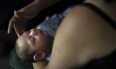 In this Dec. 16, 2016 file photo, Puerto Rico resident Michelle Flandez caresses her two-month-old son Inti Perez, diagnosed with microcephaly linked to the mosquito-borne Zika virus, in Bayamon, Puerto Rico. In the first long-term look at what happened to children of U.S. mothers who were infected with Zika during pregnancy, one in seven developed some kind of health problem _ranging from birth defects to conditions that became apparent only later. Health officials released the findings Tuesday, Aug. 7, 2018. (AP Photo/Carlos Giusti)