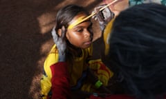 A Gumatj girl is sitting on the ground as someone paints a yellow line across her forehead. The girls face is illuminated by the sun while everything else is in shadow. The person painting her also has white paint on their hands