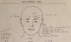 Chapman autopsy3