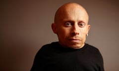 "The Imaginarium Of Doctor Parnassus" Portraits - 2009 Toronto International Film Festival<br>TORONTO, ON - SEPTEMBER 16: Actor Verne Troyer from the film "The Imaginarium Of Doctor Parnassus' poses for a portrait during the 2009 Toronto International Film Festival at The Sutton Place Hotel on September 16, 2009 in Toronto, Canada. (Photo by Matt Carr/Getty Images)