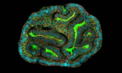 Kidney amniotic fluid organoids resembling renal tubules