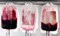 Donor blood in three blood bags