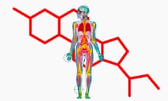 Coloured MRI whole body scan of a man with areas triggered by stress highlighted.