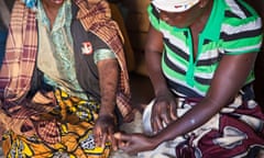 A woman who is very unwell with AIDS shows her skin condition to her visiting friend and carer in a small village in Manica District, Mozambique, 27 August, 2012 . The carer is part of Kubatsirana charity that aims to increase HIV awareness and supports people affected by the disease and poverty. 