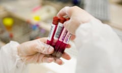 A doctor holding blood samples